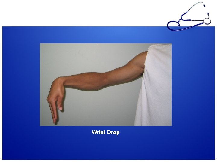 Wrist Drop 
