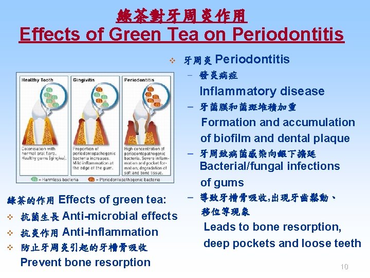 綠茶對牙周炎作用 Effects of Green Tea on Periodontitis v 牙周炎 Periodontitis – 發炎病症 Inflammatory disease