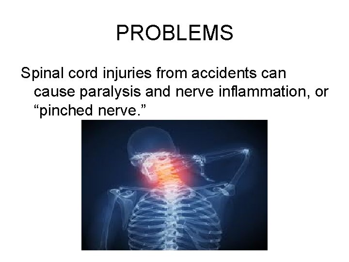 PROBLEMS Spinal cord injuries from accidents can cause paralysis and nerve inflammation, or “pinched