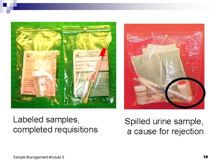 Labeled samples, completed requisitions Sample Management-Module 5 Spilled urine sample, a cause for rejection