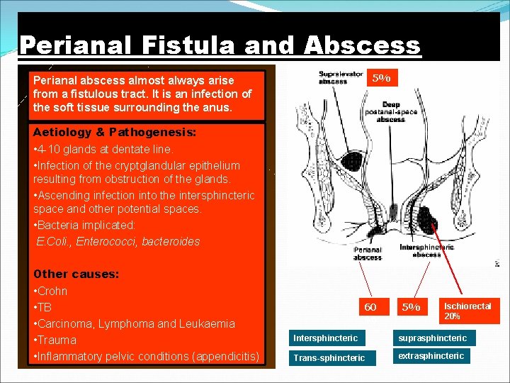 Perianal Fistula and Abscess 5% Perianal abscess almost always arise from a fistulous tract.