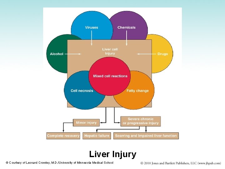 Liver Injury © Courtesy of Leonard Crowley, M. D. /University of Minnesota Medical School