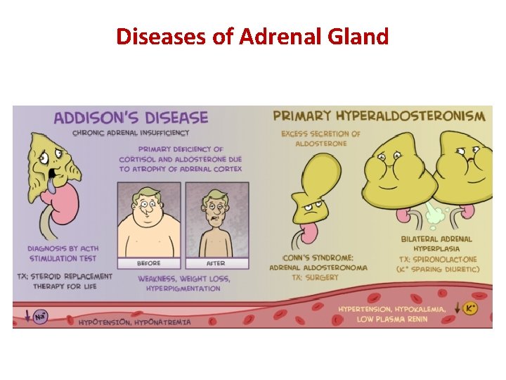 Diseases of Adrenal Gland 