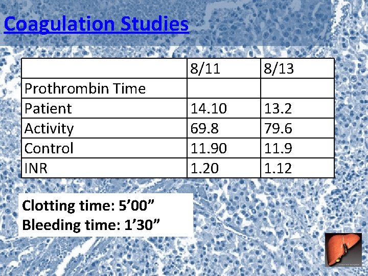 Coagulation Studies Prothrombin Time Patient Activity Control INR Clotting time: 5’ 00” Bleeding time: