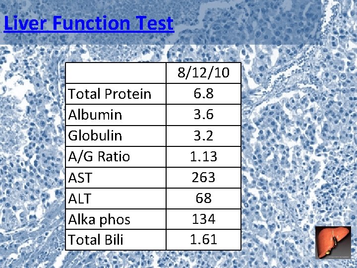 Liver Function Test Total Protein Albumin Globulin A/G Ratio AST ALT Alka phos Total