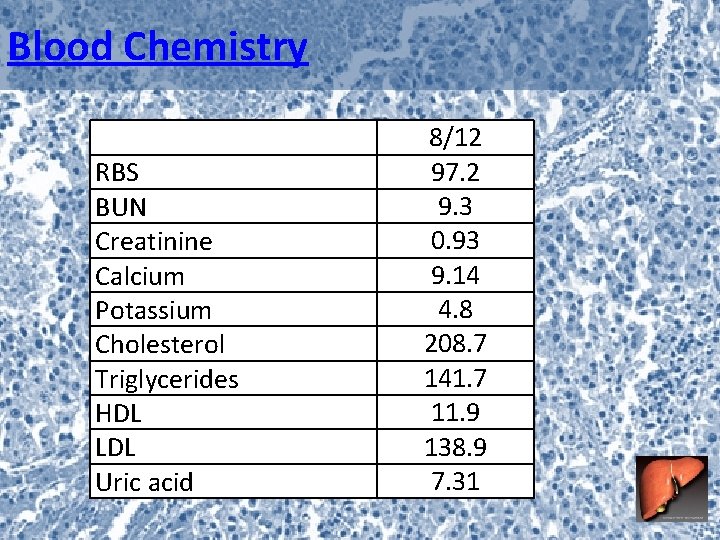 Blood Chemistry RBS BUN Creatinine Calcium Potassium Cholesterol Triglycerides HDL LDL Uric acid 8/12