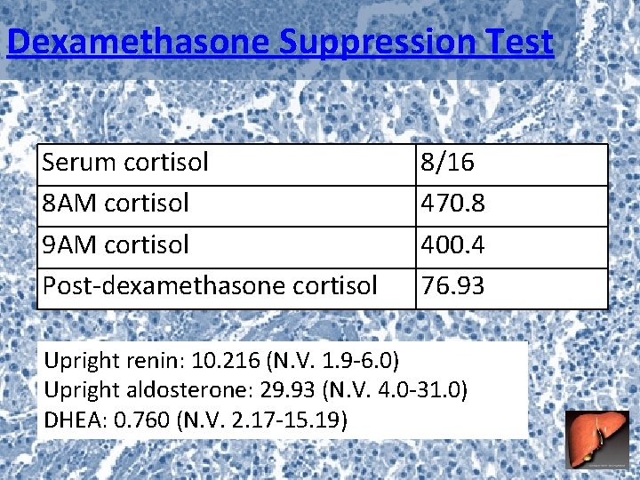 Dexamethasone Suppression Test Serum cortisol 8 AM cortisol 9 AM cortisol Post-dexamethasone cortisol 8/16