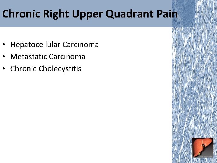Chronic Right Upper Quadrant Pain • Hepatocellular Carcinoma • Metastatic Carcinoma • Chronic Cholecystitis
