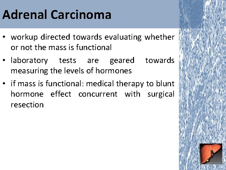 Adrenal Carcinoma • workup directed towards evaluating whether or not the mass is functional