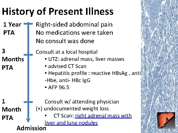 History of Present Illness 1 Year PTA Right-sided abdominal pain No medications were taken