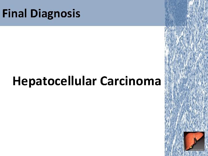 Final Diagnosis Hepatocellular Carcinoma 