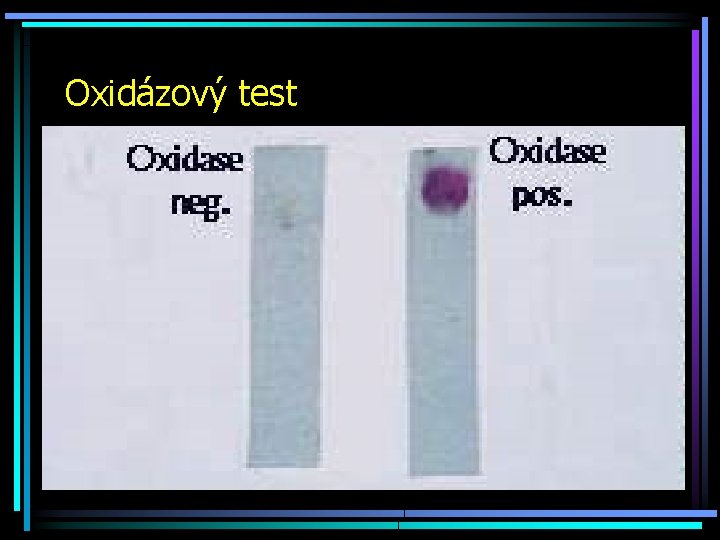 Oxidázový test 