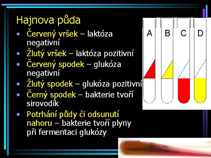 Hajnova půda • Červený vršek – laktóza negativní • Žlutý vršek – laktóza pozitivní