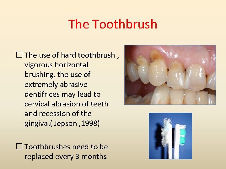 The Toothbrush � The use of hard toothbrush , vigorous horizontal brushing, the use