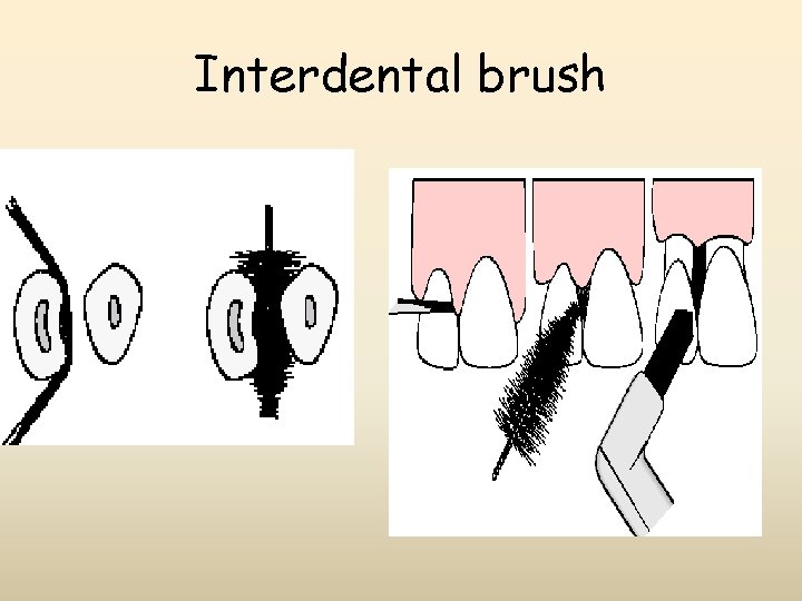 Interdental brush 