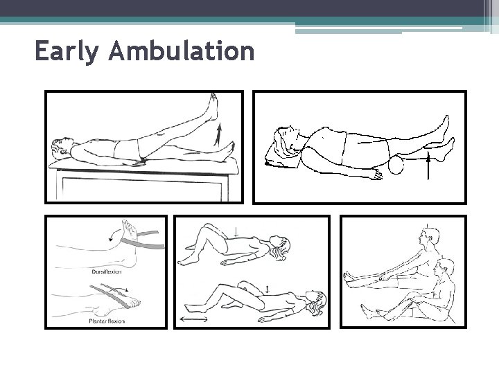 Early Ambulation 