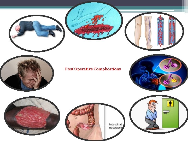 Post Operative Complications 