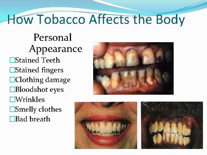 How Tobacco Affects the Body Personal Appearance �Stained Teeth �Stained fingers �Clothing damage �Bloodshot