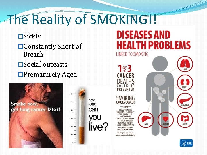 The Reality of SMOKING!! �Sickly �Constantly Short of Breath �Social outcasts �Prematurely Aged 