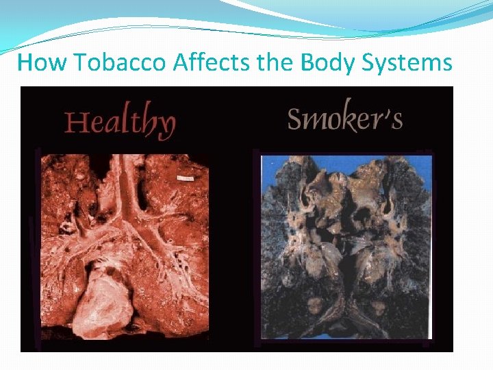 How Tobacco Affects the Body Systems 