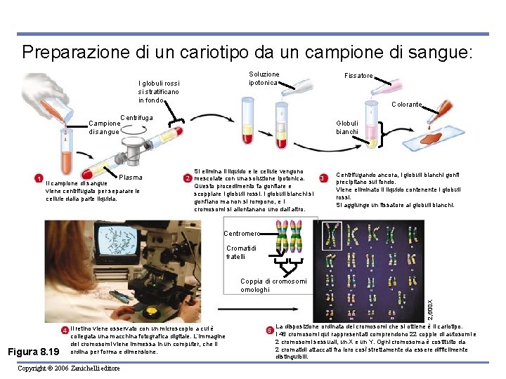 Preparazione di un cariotipo da un campione di sangue: Soluzione ipotonica I globuli rossi