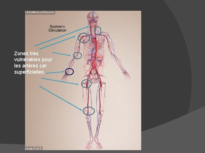 Zones très vulnérables pour les artères car superficielles 