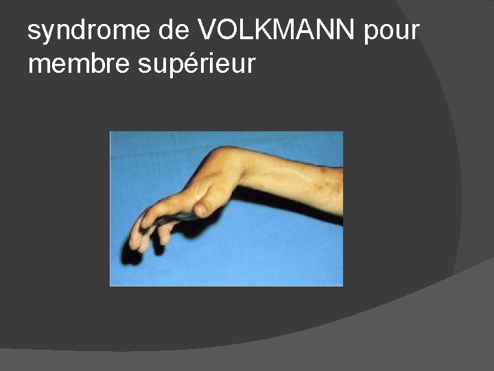 syndrome de VOLKMANN pour membre supérieur 