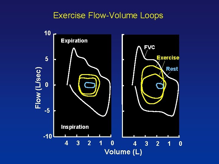 Exercise Flow-Volume Loops 10 Expiration FVC Exercise Flow (L/sec) 5 Rest 0 -5 Inspiration