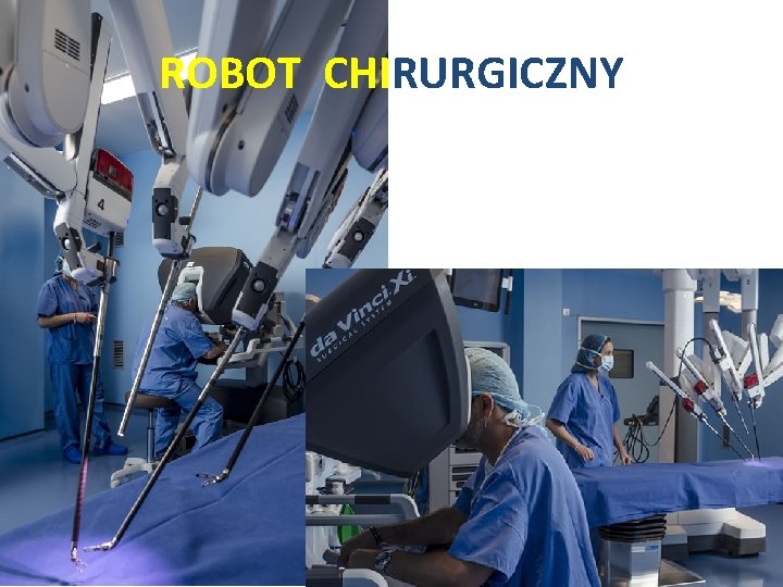 ROBOT CHIRURGICZNY 