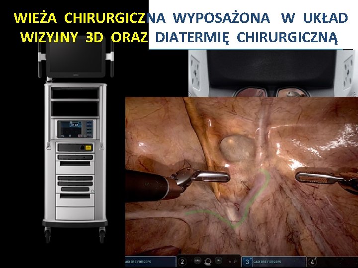 WIEŻA CHIRURGICZNA WYPOSAŻONA W UKŁAD WIZYJNY 3 D ORAZ DIATERMIĘ CHIRURGICZNĄ Układ wizyjny robota