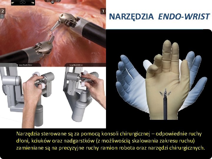 NARZĘDZIA ENDO-WRIST Narzędzia sterowane są za pomocą konsoli chirurgicznej – odpowiednie ruchy dłoni, kciuków