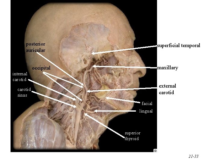 posterior auricular superficial temporal maxillary occipital internal carotid external carotid sinus facial lingual superior