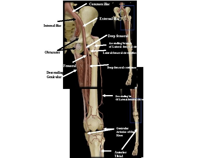 Common iliac External iliac Internal iliac Deep femoral Ascending branch of Lateral femoral circumflex
