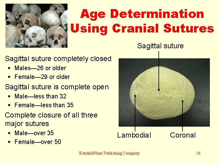 Age Determination Using Cranial Sutures Sagittal suture completely closed Males— 26 or older Female—