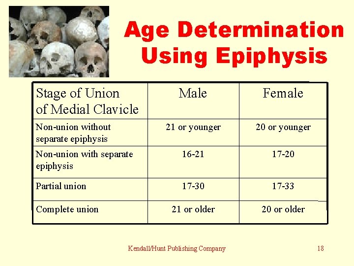 Age Determination Using Epiphysis Stage of Union of Medial Clavicle Male Female 21 or