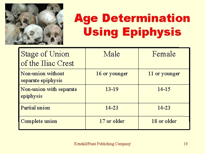 Age Determination Using Epiphysis Stage of Union of the Iliac Crest Male Female 16