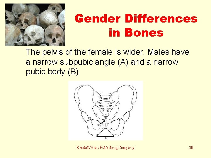 Gender Differences in Bones The pelvis of the female is wider. Males have a