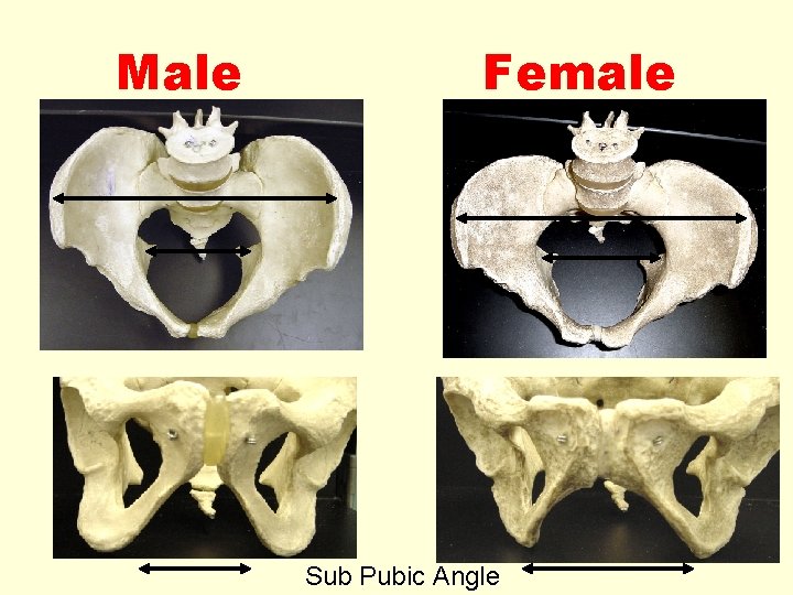 Male Female Sub Pubic Angle 