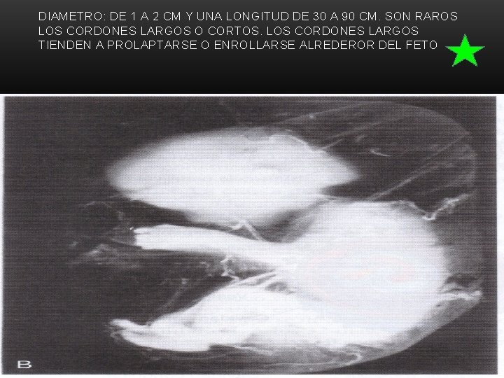 DIAMETRO: DE 1 A 2 CM Y UNA LONGITUD DE 30 A 90 CM.
