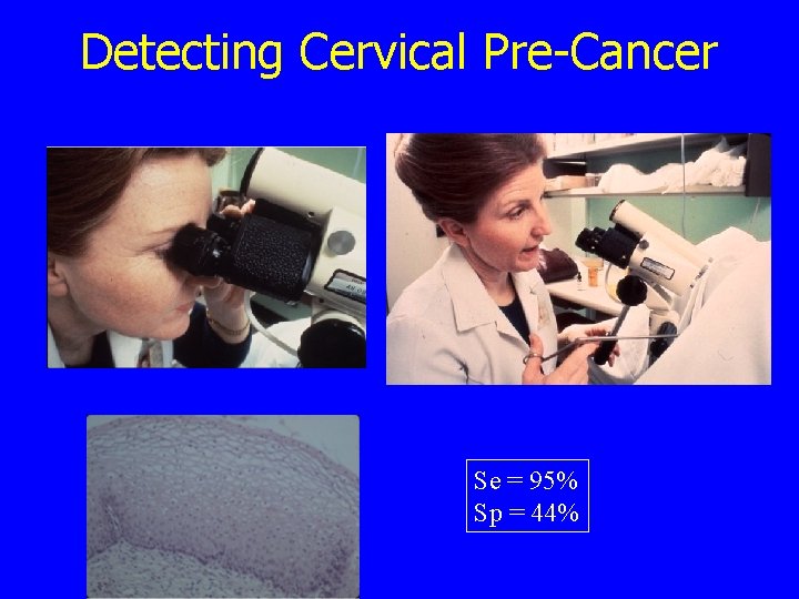 Detecting Cervical Pre-Cancer Se = 95% Sp = 44% 