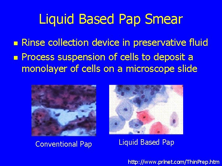 Liquid Based Pap Smear n n Rinse collection device in preservative fluid Process suspension