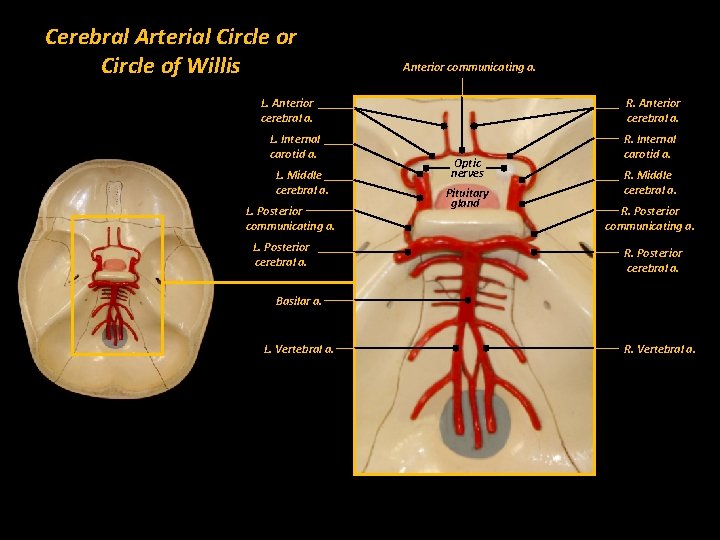 Cerebral Arterial Circle or Circle of Willis Anterior communicating a. L. Anterior cerebral a.