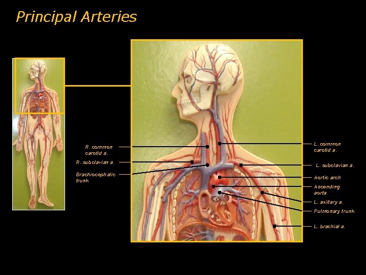 Principal Arteries R. common carotid a. R. subclavian a. Brachiocephalic trunk L. common carotid Principal Arteries R. common carotid a. R. subclavian a. Brachiocephalic trunk L. common carotid