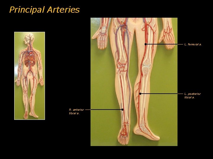 Principal Arteries L. femoral a. L. posterior tibial a. R. anterior tibial a.  Principal Arteries L. femoral a. L. posterior tibial a. R. anterior tibial a.