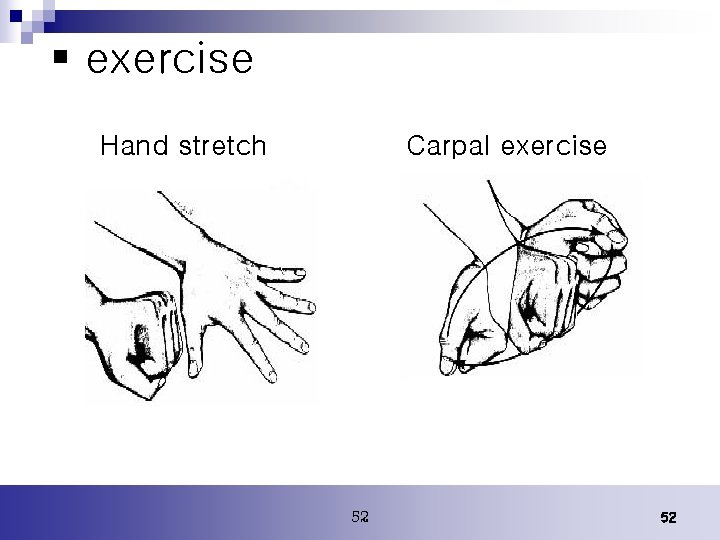 § exercise Hand stretch Carpal exercise 52 52 § exercise Hand stretch Carpal exercise 52 52