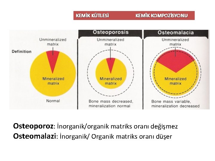 KEMİK KÜTLESİ KEMİK KOMPOZİSYONU Osteoporoz: İnorganik/organik matriks oranı değişmez Osteomalazi: İnorganik/ Organik matriks oranı