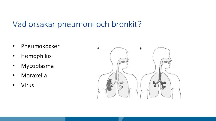 Vad orsakar pneumoni och bronkit? • Pneumokocker • Hemophilus • Mycoplasma • Moraxella •