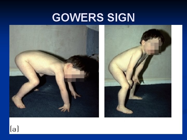 GOWERS SIGN 