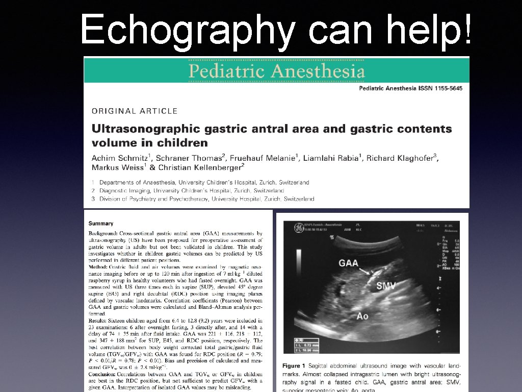 Echography can help! 