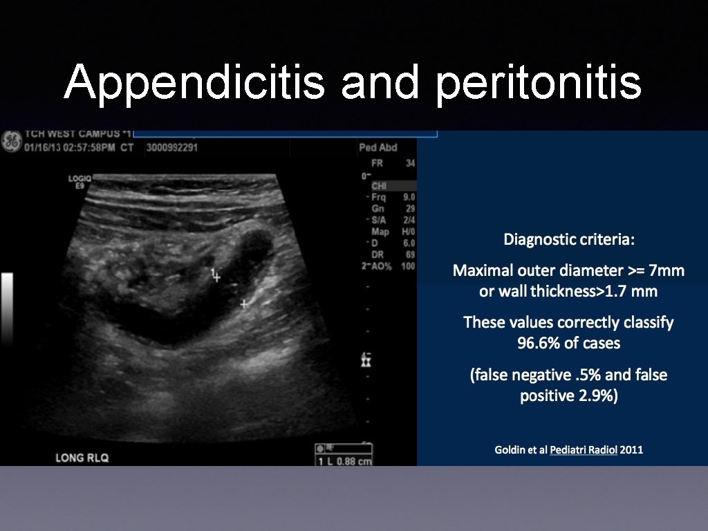 Appendicitis and peritonitis 
